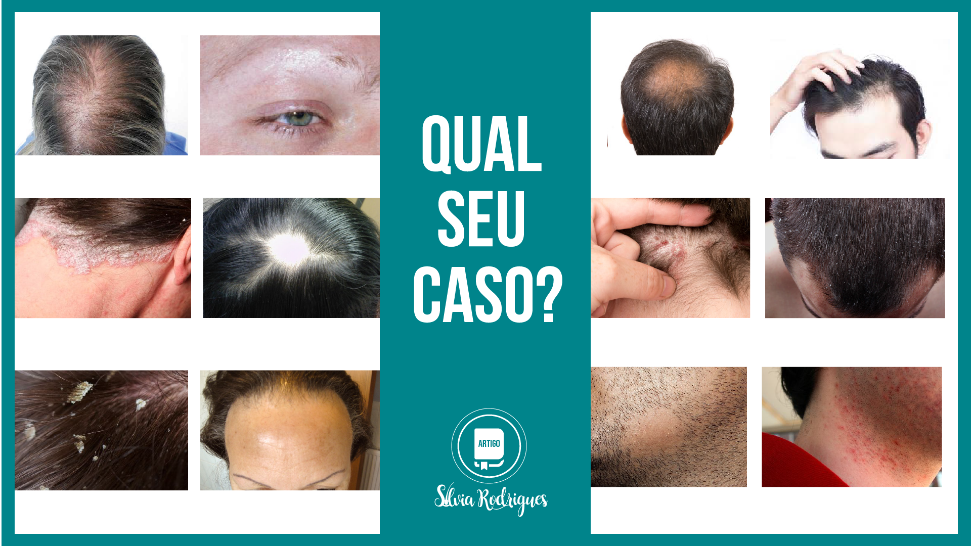 Qual seu caso?
