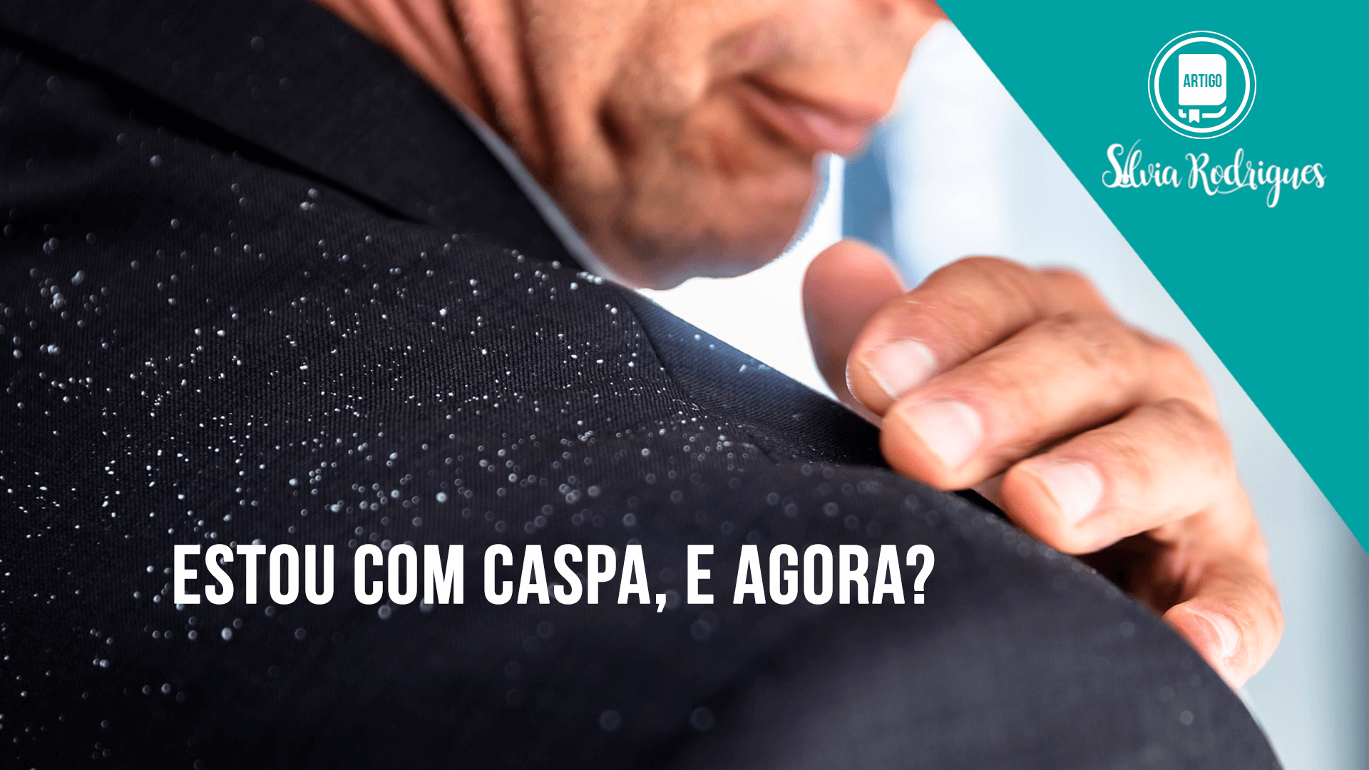 Estou com caspa, e agora?